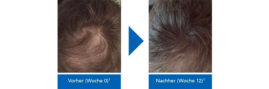 Vorher/Nachher Männer